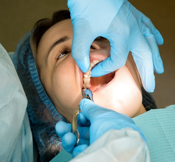 what-to-expect-during-a-tooth-extraction